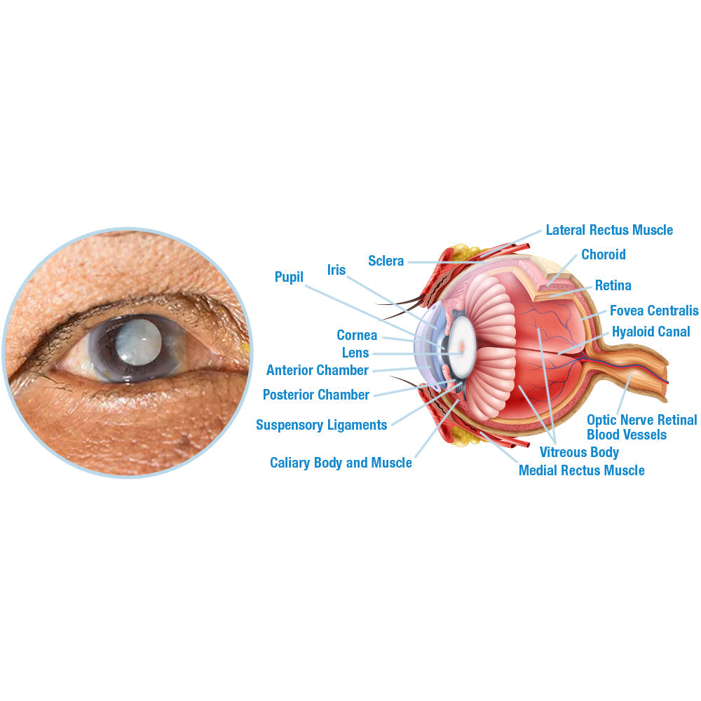 GFOUK™ OphthalTech Vision Vitality Electric Device