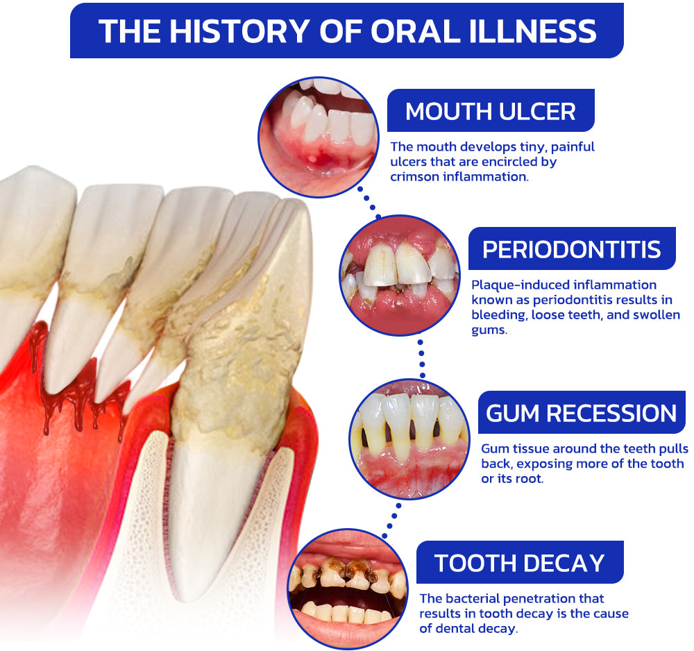 đĽFurzero⢠EaseSmile Gums Therapy & Pain Relief Probiotics Bee Venom Chicles (đŚđşADA Proven) BLIS K12 & M18, Fights Periodontitis, Gingivitis, Gum And Teeth Pain, Gum Recession, Inflammation, Tartar, Strep Throat