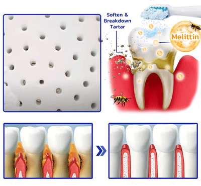 🎖Furzero™ Focussmile Bee Venom Gum Therapy Oral Powder 🦷(🇦🇺ADA Proven)