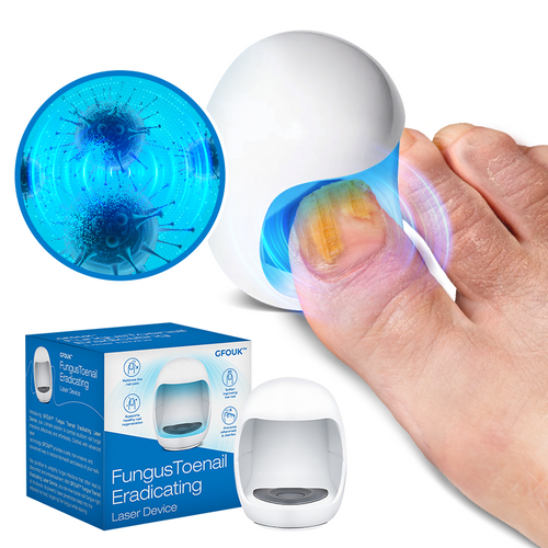 GFOUK™ Fungus Toenail Eradicating Laser Device