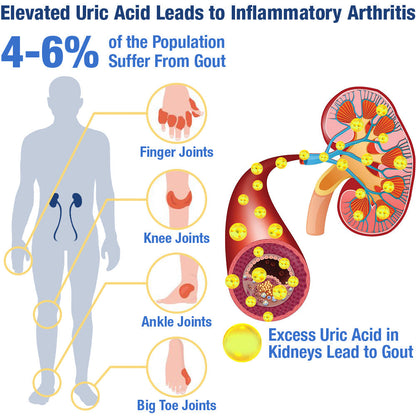 GFOUK™ UricEase Microcurrent Therapy Device