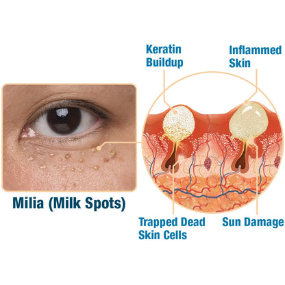 flysmus™ CaviarLuxe Far Infrared Radiance Milk Spot Cream