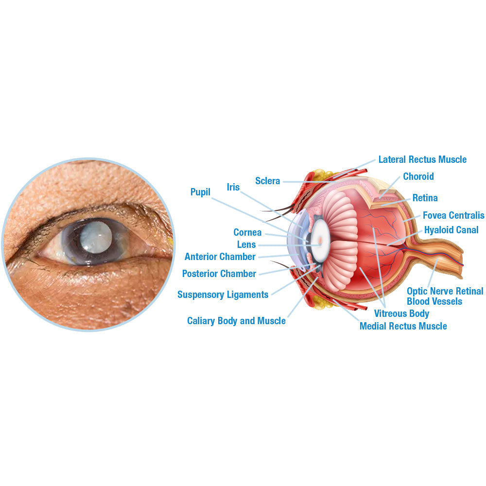 GFOUK™ OphthalTech Vision Vitality Electric Device