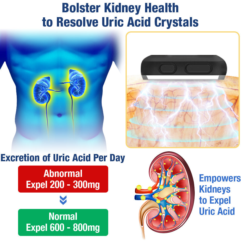GFOUK™ UricEase Microcurrent Therapy Device