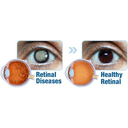 GFOUK™ OphthalTech Vision Vitality Electric Device