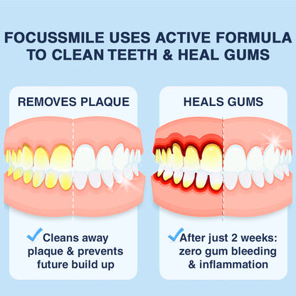 🫧Official Store🇦🇺Furzero™ Focussmile Bee Venom Treatment Oral Powder 🦷 (🇦🇺 TGA-Certified) (Treats periodontitis and mouth ulcers, prevents loose tooth & bleeding gums, and repairs gum recession)