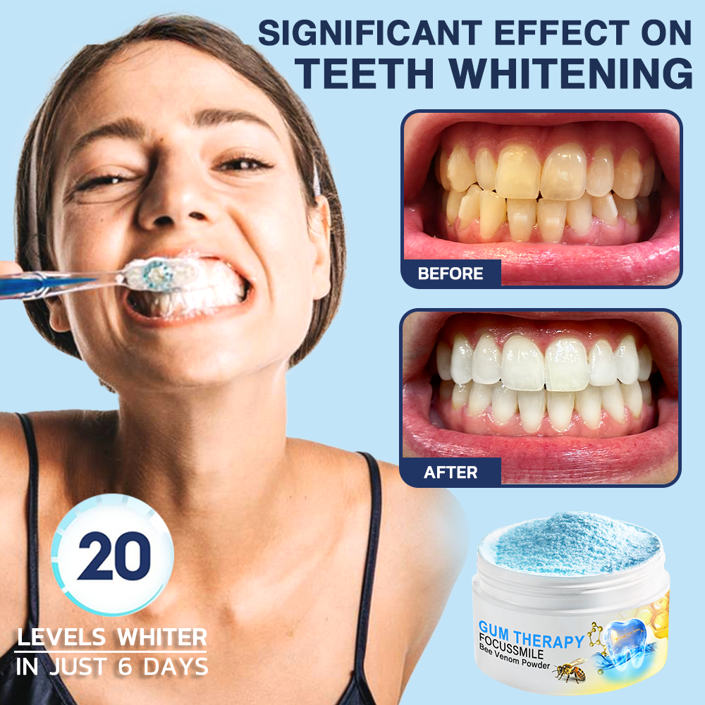 🫧Official Store🇦🇺Furzero™ Focussmile Bee Venom Treatment Oral Powder 🦷 (🇦🇺 TGA-Certified) (Treats periodontitis and mouth ulcers, prevents loose tooth & bleeding gums, and repairs gum recession)