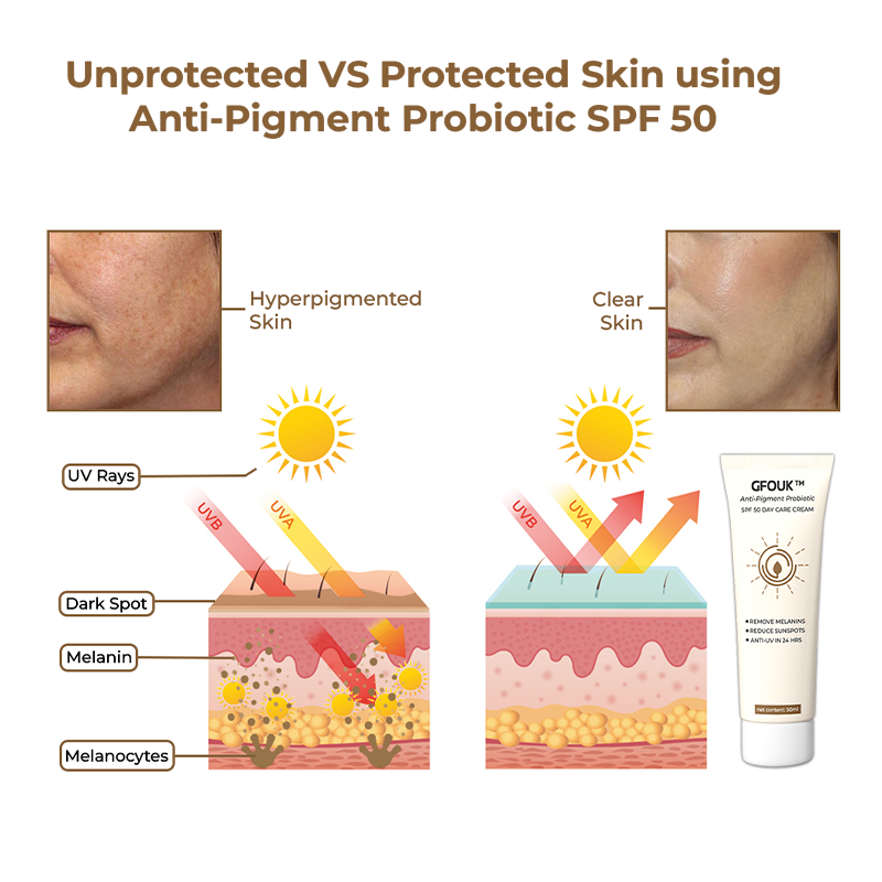 GFOUK™ Anti-Pigment Probiotic SPF 50 Day Care Cream