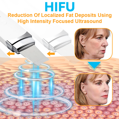 GFOUK™ HIFU Face Lifting Instrument