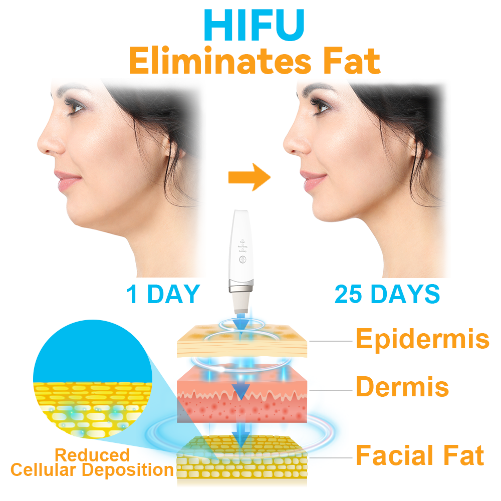 GFOUK™ HIFU Face Lifting Instrument