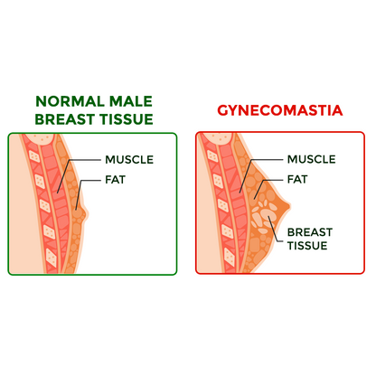 flysmus™ SoliPac Gynecomastia Tightening Herbal Cream