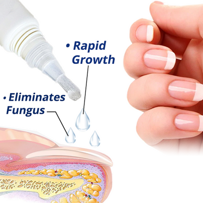 flysmus™ 7 Days Nail Recovery Rapid Growth Essence Pen