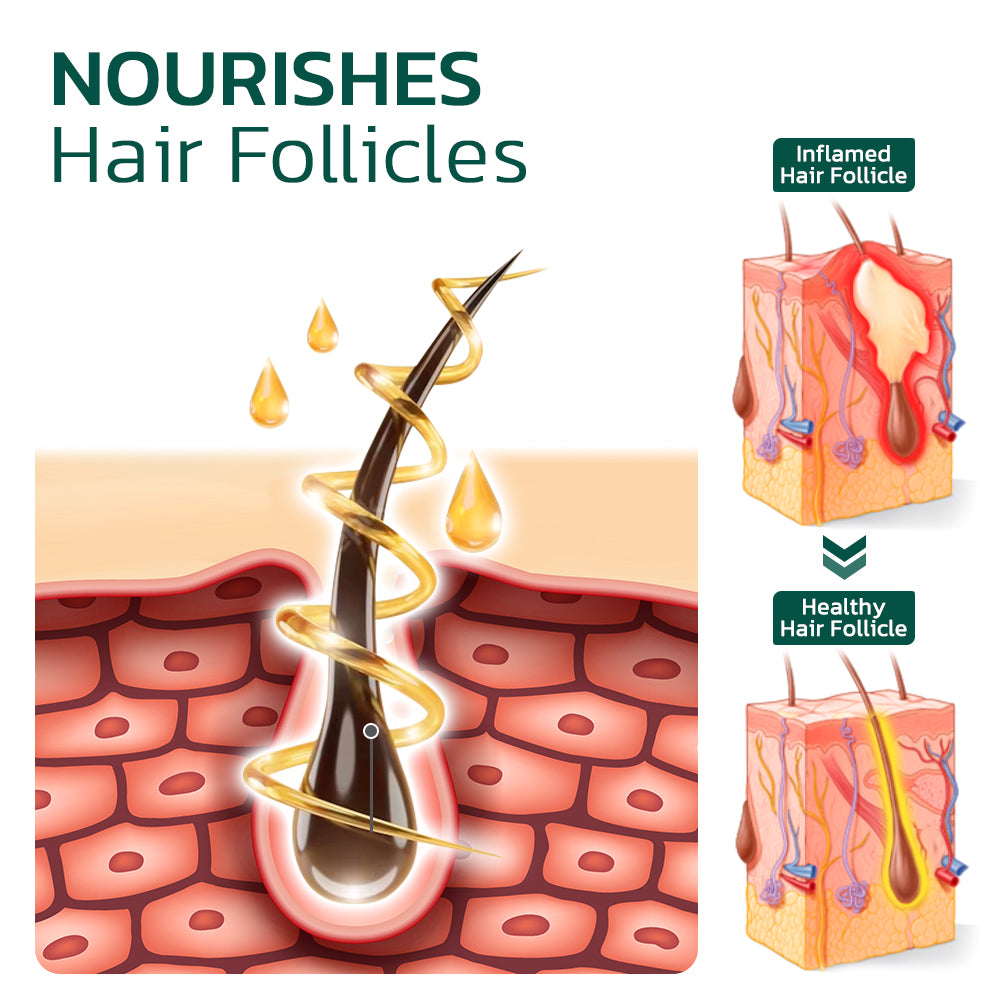 GFOUK™ Scalp Folliculitis Therapy Oil