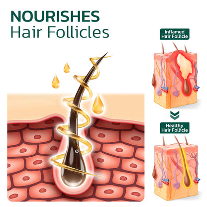 GFOUK™ Scalp Folliculitis Therapy Oil