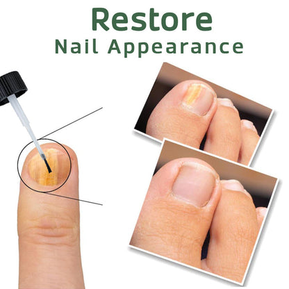 GoodNail Toe Health Gel