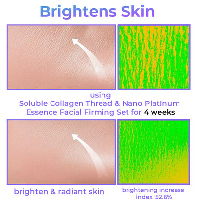 Soluble Collagen Thread & Nano Platinum Essence Facial Firming Set