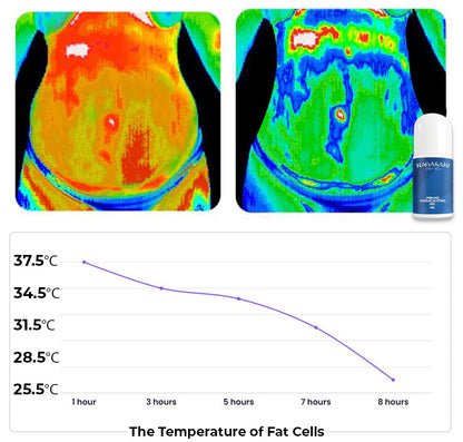 Nagasakiフローズン Precise CoolSculpting Gel